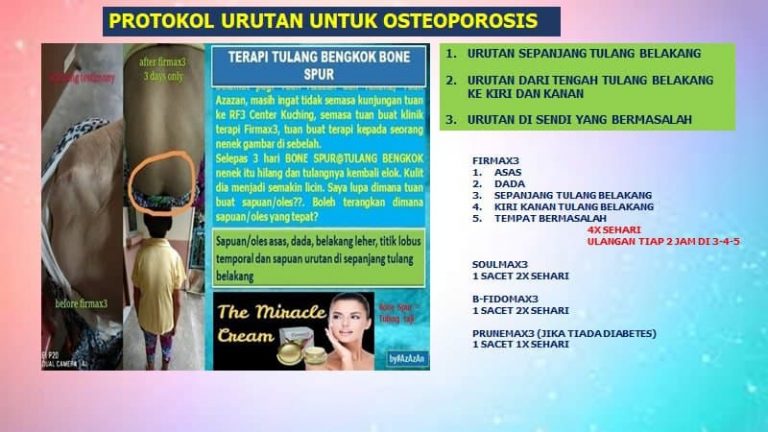 Protokol urutan untuk Osteoporosis