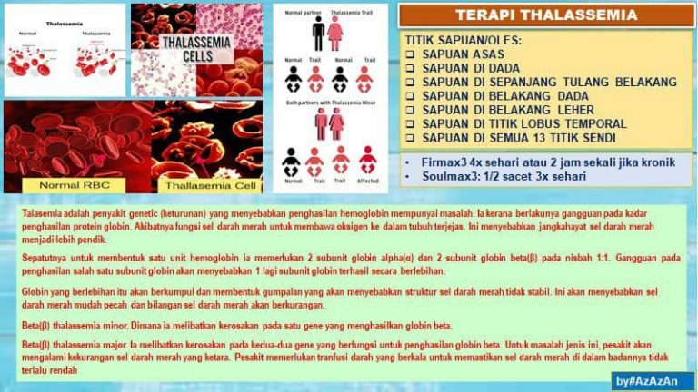 Terapi Thalassemia